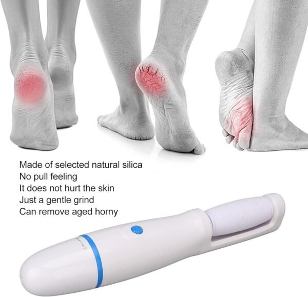 Éliminateur de callosités électrique pour pieds
