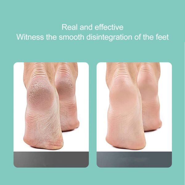 Éliminateur de callosités électrique pour pieds – Image 13