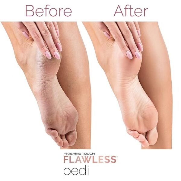 Flawless Pedi Electronic Electronic Pedicure tool – Image 9